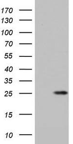 ITGB1BP1 Antibody in Western Blot (WB)