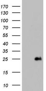 ITGB1BP1 Antibody in Western Blot (WB)