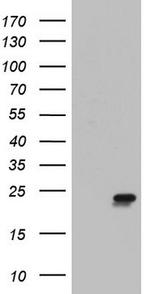 ITGB1BP1 Antibody in Western Blot (WB)
