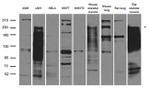 ITGB4 Antibody in Western Blot (WB)