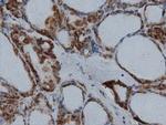 IVD Antibody in Immunohistochemistry (Paraffin) (IHC (P))