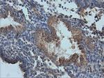 IVD Antibody in Immunohistochemistry (Paraffin) (IHC (P))