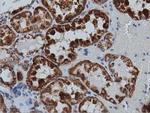 IVD Antibody in Immunohistochemistry (Paraffin) (IHC (P))