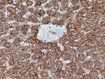 IVD Antibody in Immunohistochemistry (Paraffin) (IHC (P))