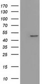 IVD Antibody in Western Blot (WB)