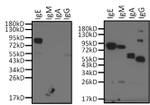 Human IgE Secondary Antibody in Western Blot (WB)