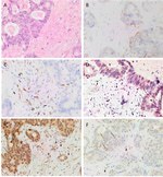 SOX2 Antibody in Immunohistochemistry (IHC)