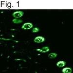 IP3 Receptor 1 Antibody in Immunohistochemistry (IHC)