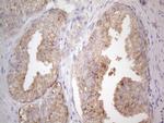 JAK2 Antibody in Immunohistochemistry (Paraffin) (IHC (P))