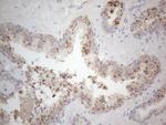 JAK2 Antibody in Immunohistochemistry (Paraffin) (IHC (P))