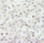 JARID1B Antibody in Immunohistochemistry (IHC)