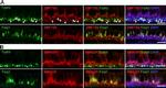 FOXJ1 Antibody in Immunohistochemistry (IHC)