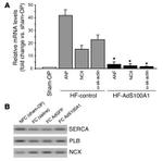 Sodium/Calcium Exchanger Antibody in Western Blot (WB)