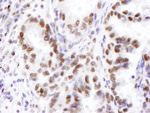 JHDM1A Antibody in Immunohistochemistry (IHC)