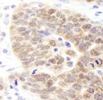 JMJD1B Antibody in Immunohistochemistry (IHC)