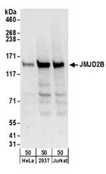 JMJD2B Antibody in Western Blot (WB)