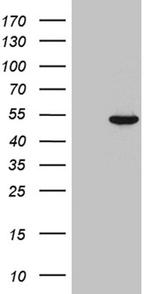 JMJD5 Antibody in Western Blot (WB)