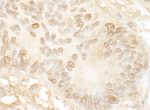 JMY Antibody in Immunohistochemistry (IHC)