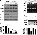 beta Amyloid Antibody in Western Blot (WB)