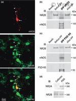 NMDAR2B Antibody in Western Blot, Immunocytochemistry (WB, ICC/IF)