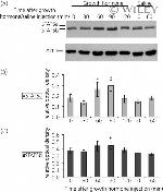 STAT5 beta Antibody in Western Blot (WB)