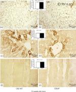 CNR2 Antibody in Immunohistochemistry (Paraffin) (IHC (P))