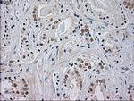 JNK1 Antibody in Immunohistochemistry (Paraffin) (IHC (P))