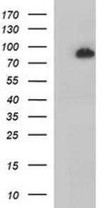 JPH2 Antibody in Western Blot (WB)