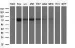 JPH2 Antibody in Western Blot (WB)