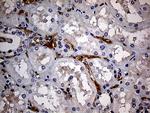 JUP Antibody in Immunohistochemistry (Paraffin) (IHC (P))