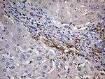 JUP Antibody in Immunohistochemistry (Paraffin) (IHC (P))