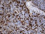 JUP Antibody in Immunohistochemistry (Paraffin) (IHC (P))