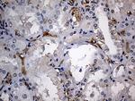 JUP Antibody in Immunohistochemistry (Paraffin) (IHC (P))