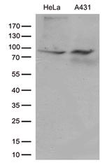 JUP Antibody in Western Blot (WB)