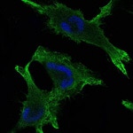 gamma Catenin Antibody in Immunocytochemistry (ICC/IF)