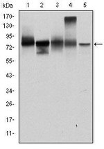 gamma Catenin Antibody in Western Blot (WB)