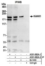 KANK1 Antibody in Western Blot (WB)