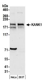 KANK1 Antibody in Western Blot (WB)