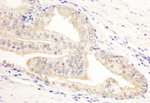 KANK2/SIP Antibody in Immunohistochemistry (IHC)