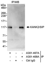 KANK2/SIP Antibody in Immunoprecipitation (IP)