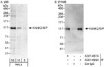 KANK2/SIP Antibody in Western Blot (WB)