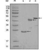 KARS Antibody in Western Blot (WB)