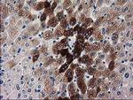 KATNAL1 Antibody in Immunohistochemistry (Paraffin) (IHC (P))