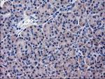 KATNAL1 Antibody in Immunohistochemistry (Paraffin) (IHC (P))