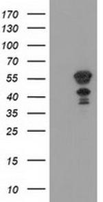 KATNAL1 Antibody in Western Blot (WB)