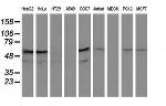 KATNAL1 Antibody in Western Blot (WB)