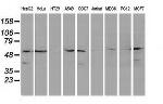 KATNAL1 Antibody in Western Blot (WB)