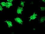 KATNB1 Antibody in Immunocytochemistry (ICC/IF)