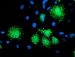 KATNB1 Antibody in Immunocytochemistry (ICC/IF)