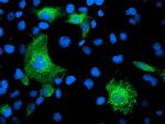 KATNB1 Antibody in Immunocytochemistry (ICC/IF)